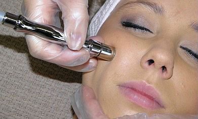 Diamond Microdermabrasion