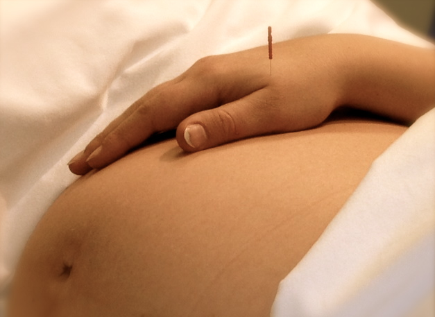 Acupuncture During Pregnancy and labor