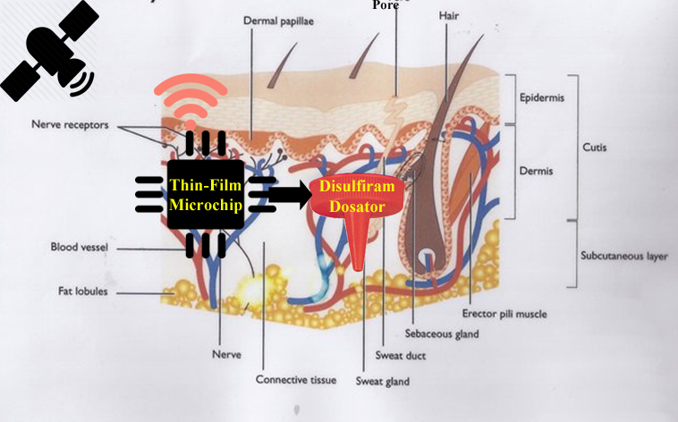 esperal-implant-network