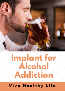 Implant For Alcohol Addiction 