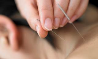 Parathyroid disease acupuncture treatment