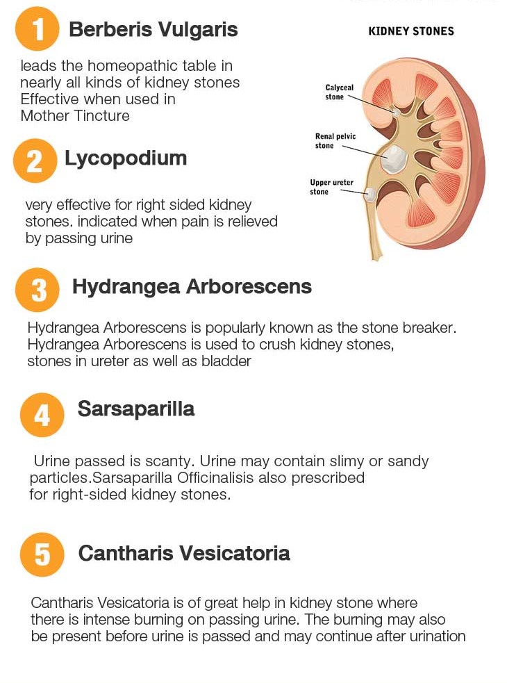 Kidney stones natural treatment
