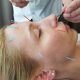 Facial acupuncture