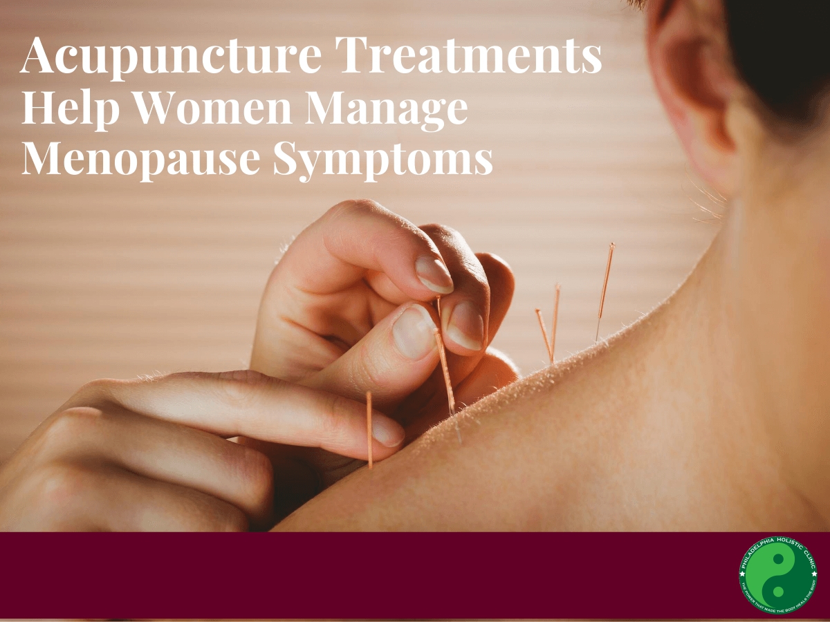 Acupuncture