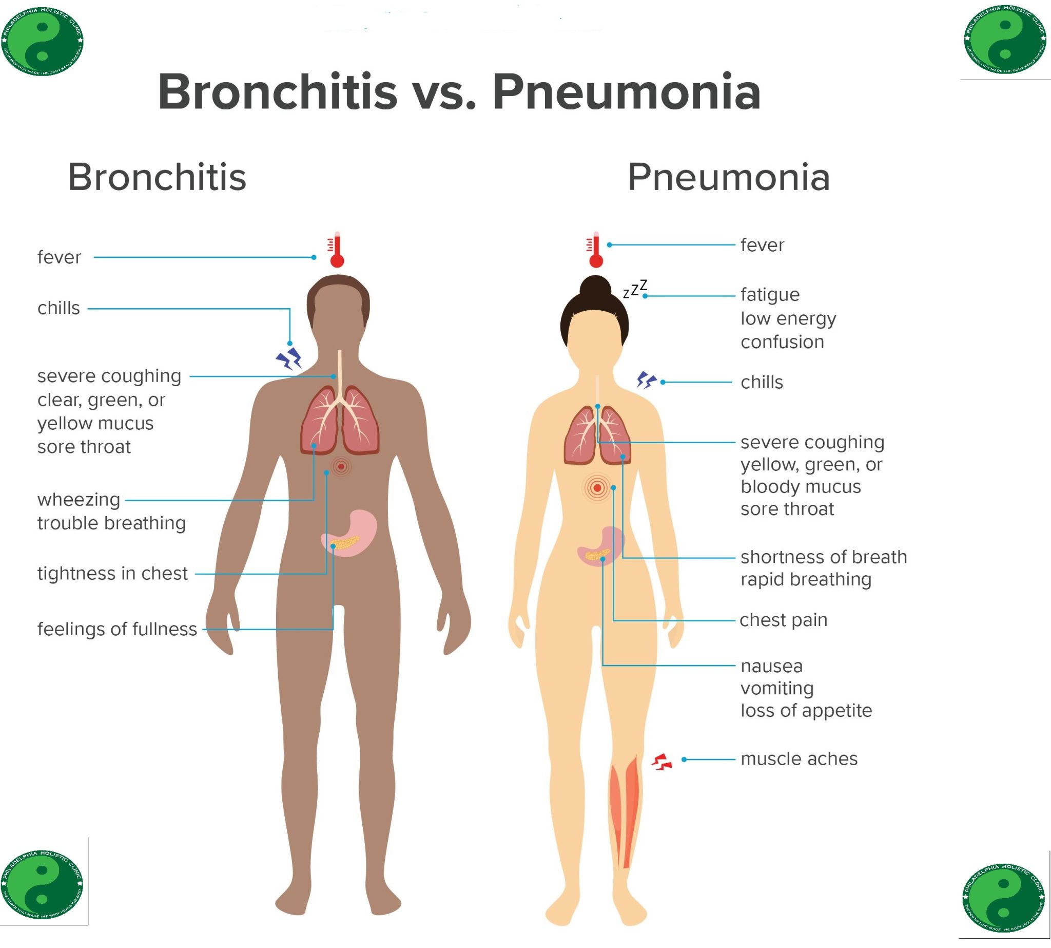 Distinguishing Bronchitis from Pneumonia
