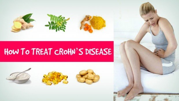 Natural Treatments for Crhohn's disease
