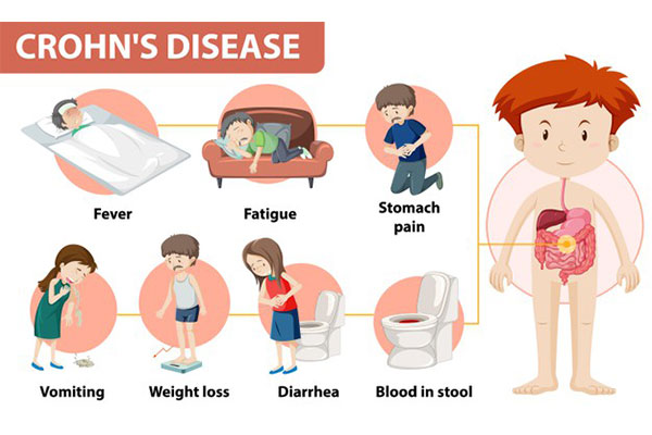 Symptoms