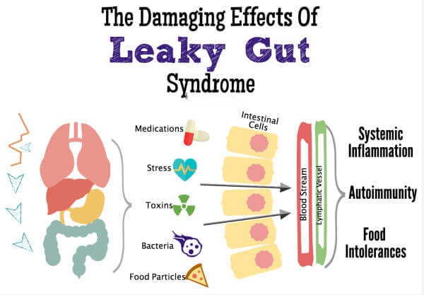 Leaky gut pathology