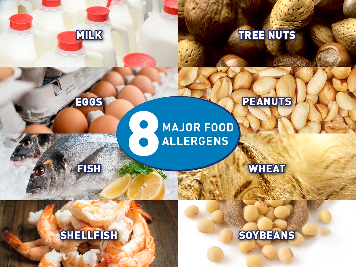 The most common food allergies