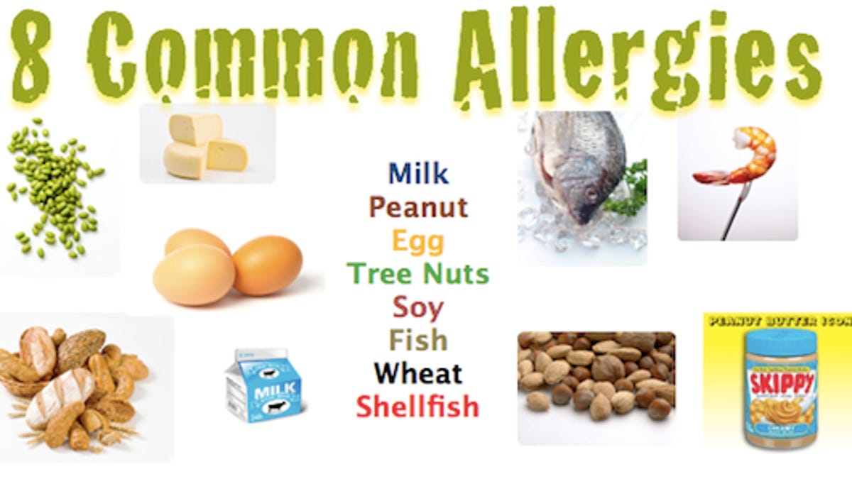 Food allergies